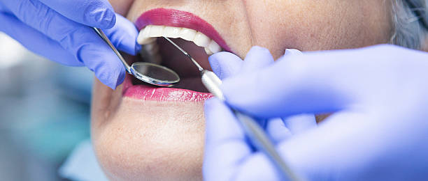 Best Emergency Dentist for Lost Fillings or Crowns in Seagoville, TX